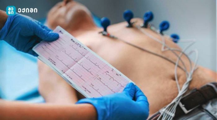ECG Test